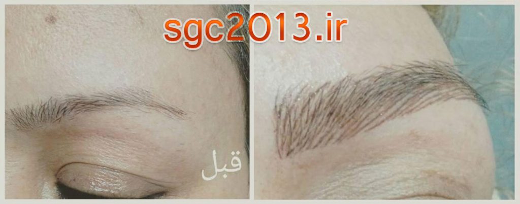 قیمت و هزینه میکروپیگمنتیشن هاشور ابرو